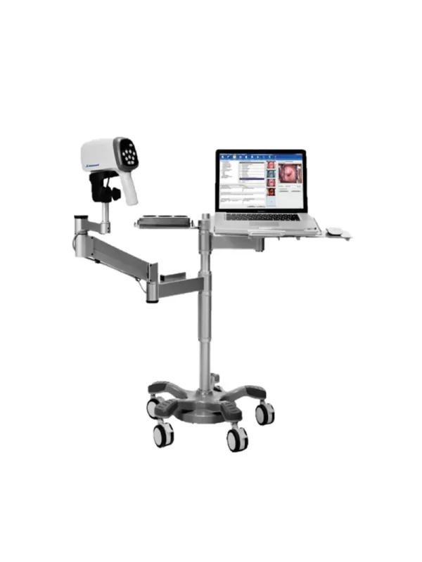 Imagen-de-Video-Colposcope Video Colposcopio