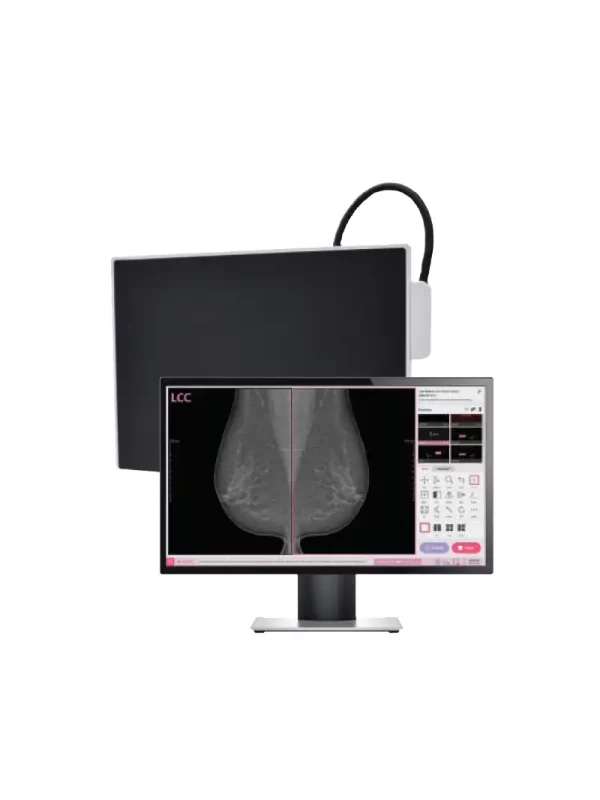 Mamografía-Digital Mamografía Digital