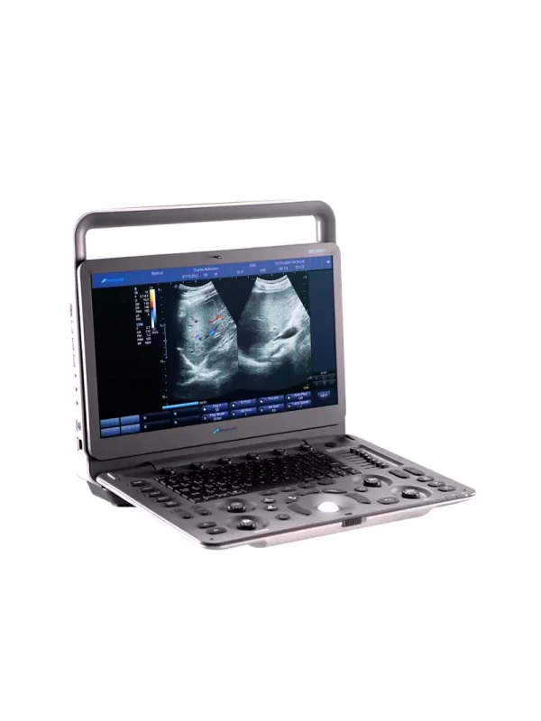 Sistema de Ultrasonido DUS - 5000 + Sistema de Ultrasonido DUS - 5000 +